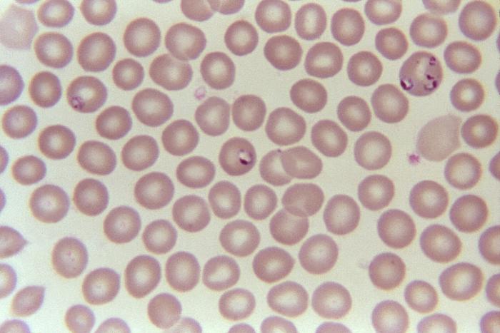 Blood smear photomicrograph.